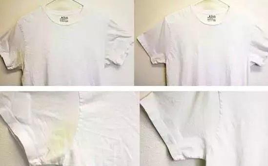 衣服发黄了怎么办?